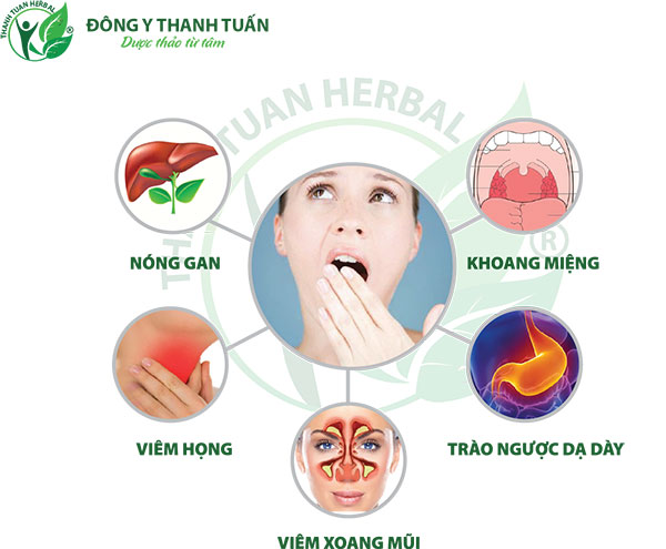 5 nguyên nhân hôi miệng