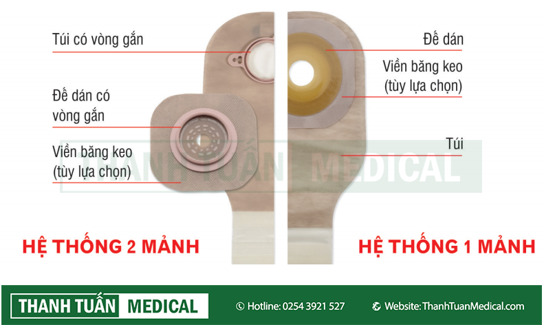 bộ-túi-hậu-môn-nhân-tạo