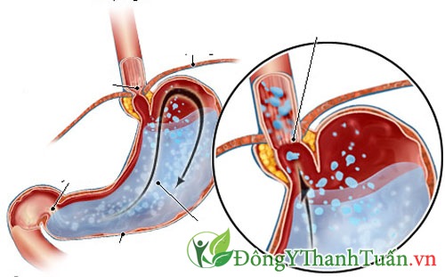 cách chữa hôi miệng cho bà bầu4