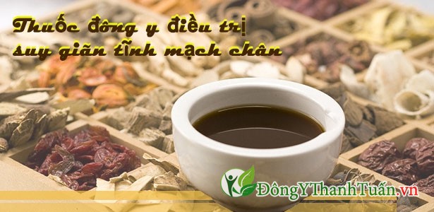 Cách điều trị giãn tĩnh mạch chân