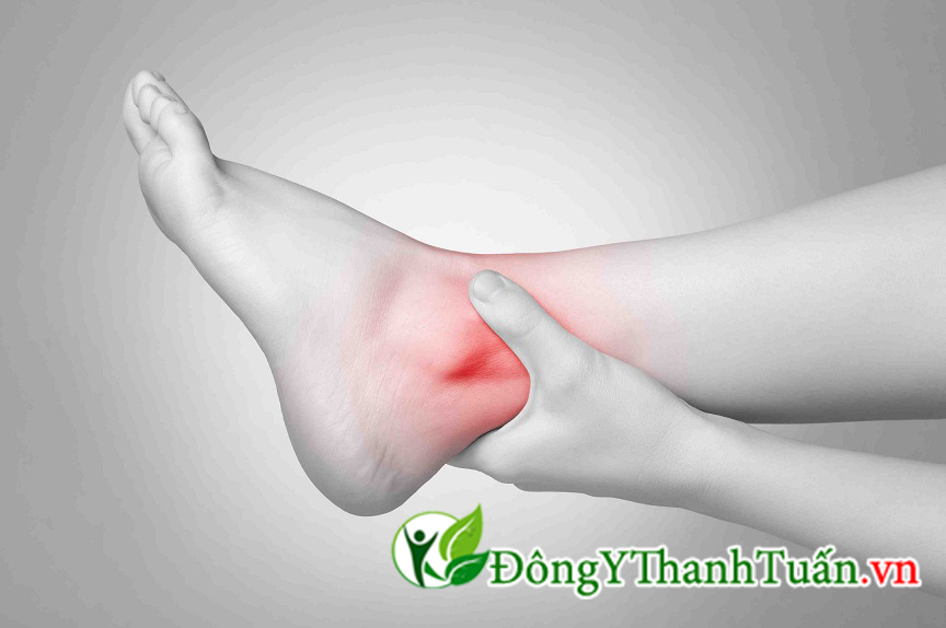 Mang vớ y tế phòng giãn tĩnh mạch dưới