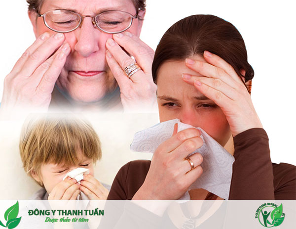 Dấu hiệu viêm xoang hàm là nghẹt mũi