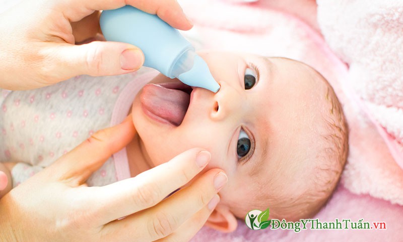 Không nên hút mũi nhiều lần ở trẻ