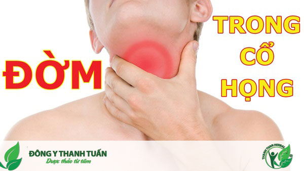 Làm thế nào để điều trị đờm ở cổ họng có mùi hôi?