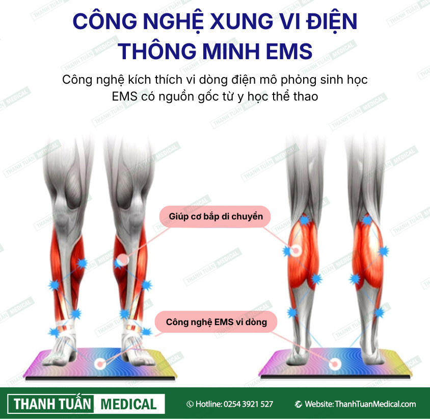 Công nghệ EMS tiên tiến vượt trội Công nghệ EMS tiên tiến vượt trội