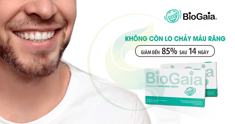 Người bị viêm lợi nên sử dụng Biogaia Prodentis