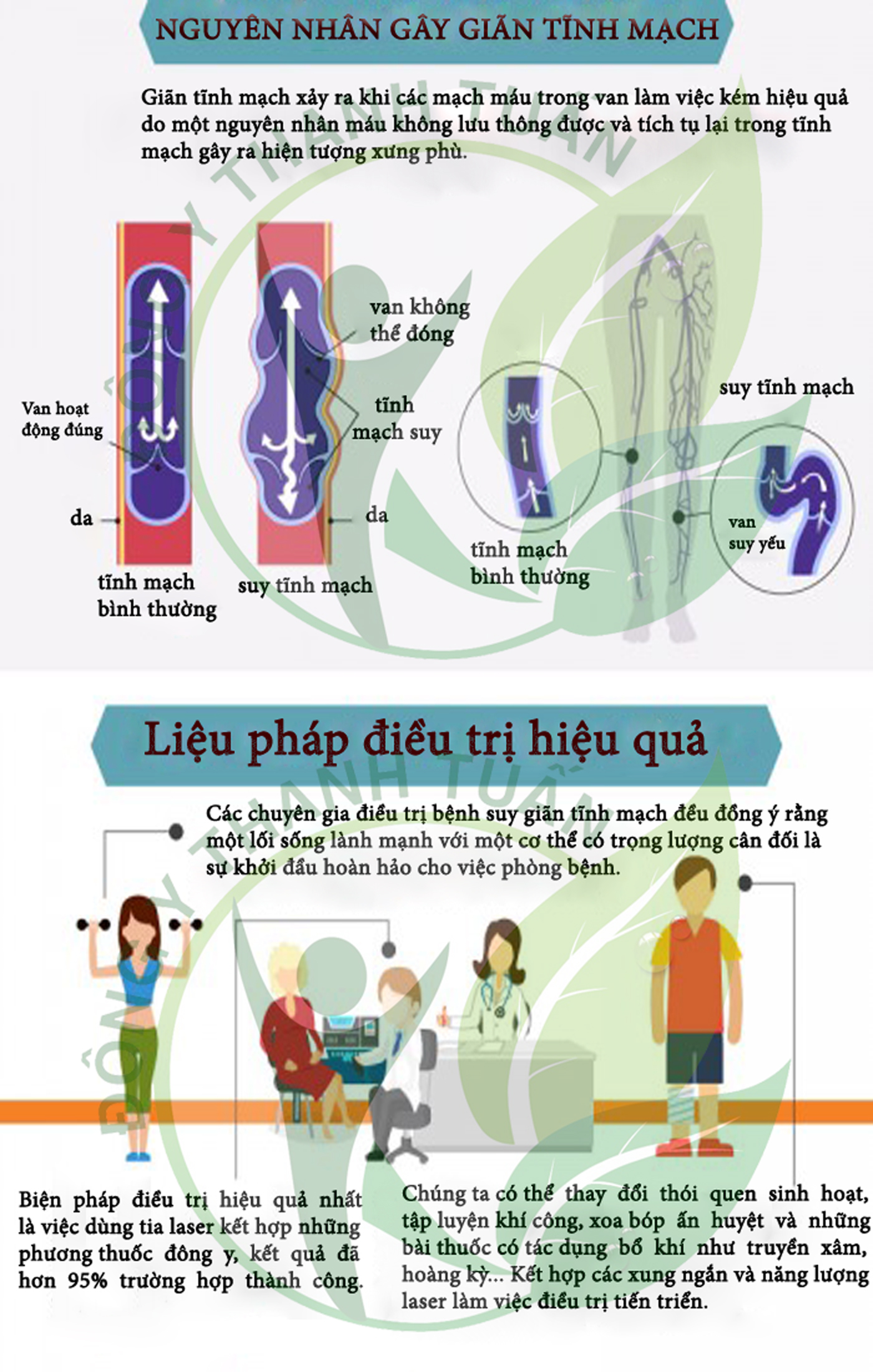 nguyên nhân và liệu pháp điều trị bệnh suy giãn tĩnh mạch