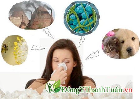 Những tác nhân cần tránh để trị bệnh viêm mũi dị ứng dứt điểm
