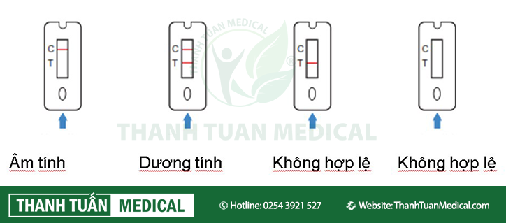 Phiên giải kết quả