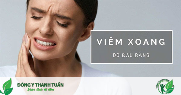 Sâu răng gây viêm xoang hàm