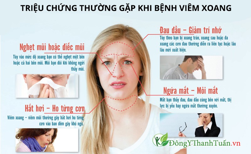 Triệu chứng thường gặp khi bị viêm mũi, viêm xoang