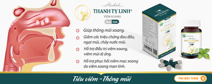 viêm xoang mũi 001