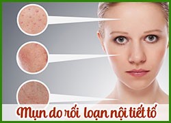 Hoocmon - Nội Tiết